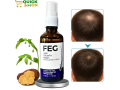 feg-plus-hair-growth-spray-in-karachi-regrow-your-hair-naturally-03001819306-small-0